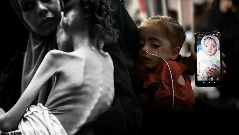 Küçük Meryem’in Açlıkla Mücadelesi: 25 Kilodan 10 Kiloya Düşüşü