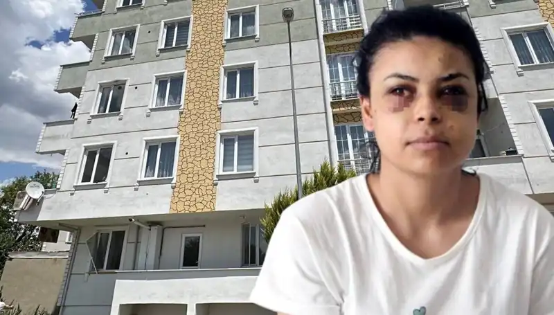 Düğün Kutlamasında Maganda Dehşeti: Saçmalar Gözüne İsabet Eden Kurban