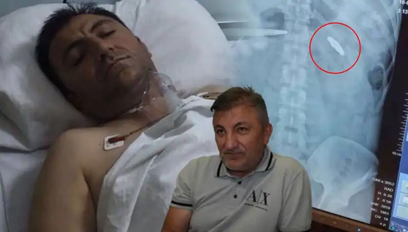 15 Temmuz'un İzleri: Yıllar Geçse de Unutulmayan Kurşun Yaraları