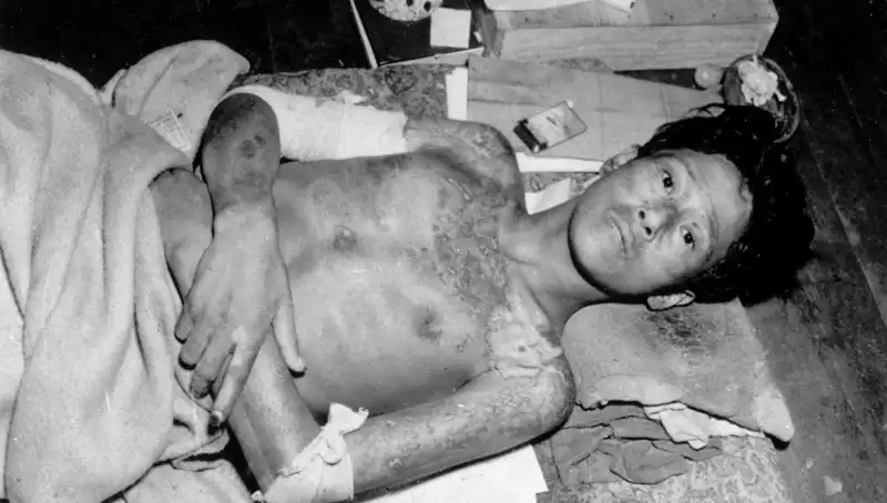 Nagasaki'den Son Çağrı: Nükleer Felaket Tehlikesi Kapıda mı?